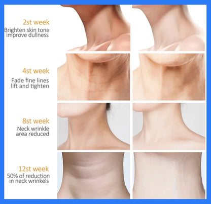 Creme para o Pescoço com Colágeno Elimina Rugas no Pescoço, Levanta, Clareia, Firmar Duplo Queixo, Anti-envelhecimento e Rejuvenescimento, Produto de Cuidados com a Pele